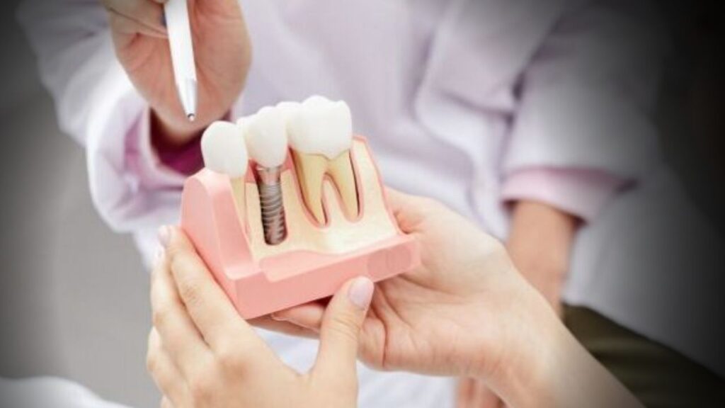 Recuperación y Cuidados Postoperatorios