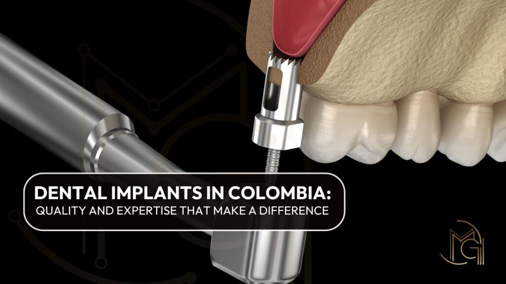 Dental Implants in ColombiaQuality and Expertise that Make a Difference