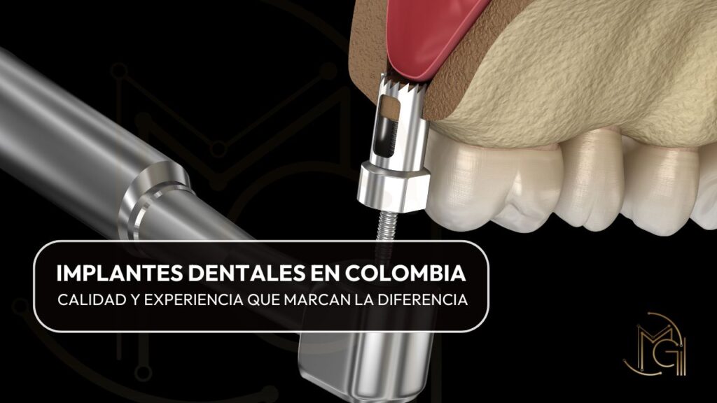 Implantes Dentales en Colombia: Calidad y Experiencia que Marcan la Diferencia