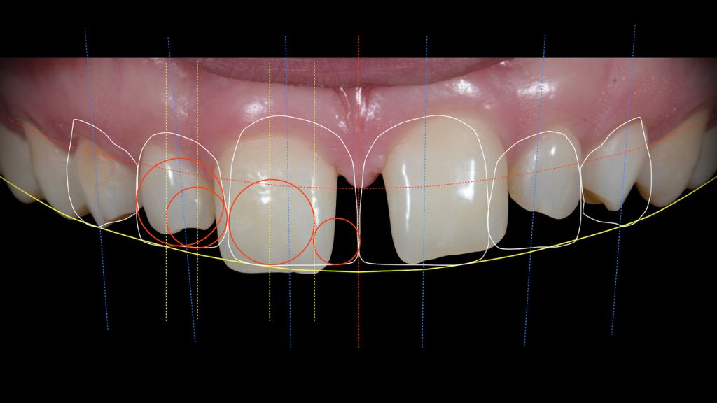 Dra. Carolina Gil – Estética Dental de Alta Calidad