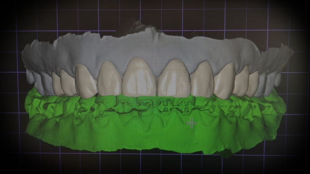 Dra. Carolina Gil – Estética Dental de Alta Calidad