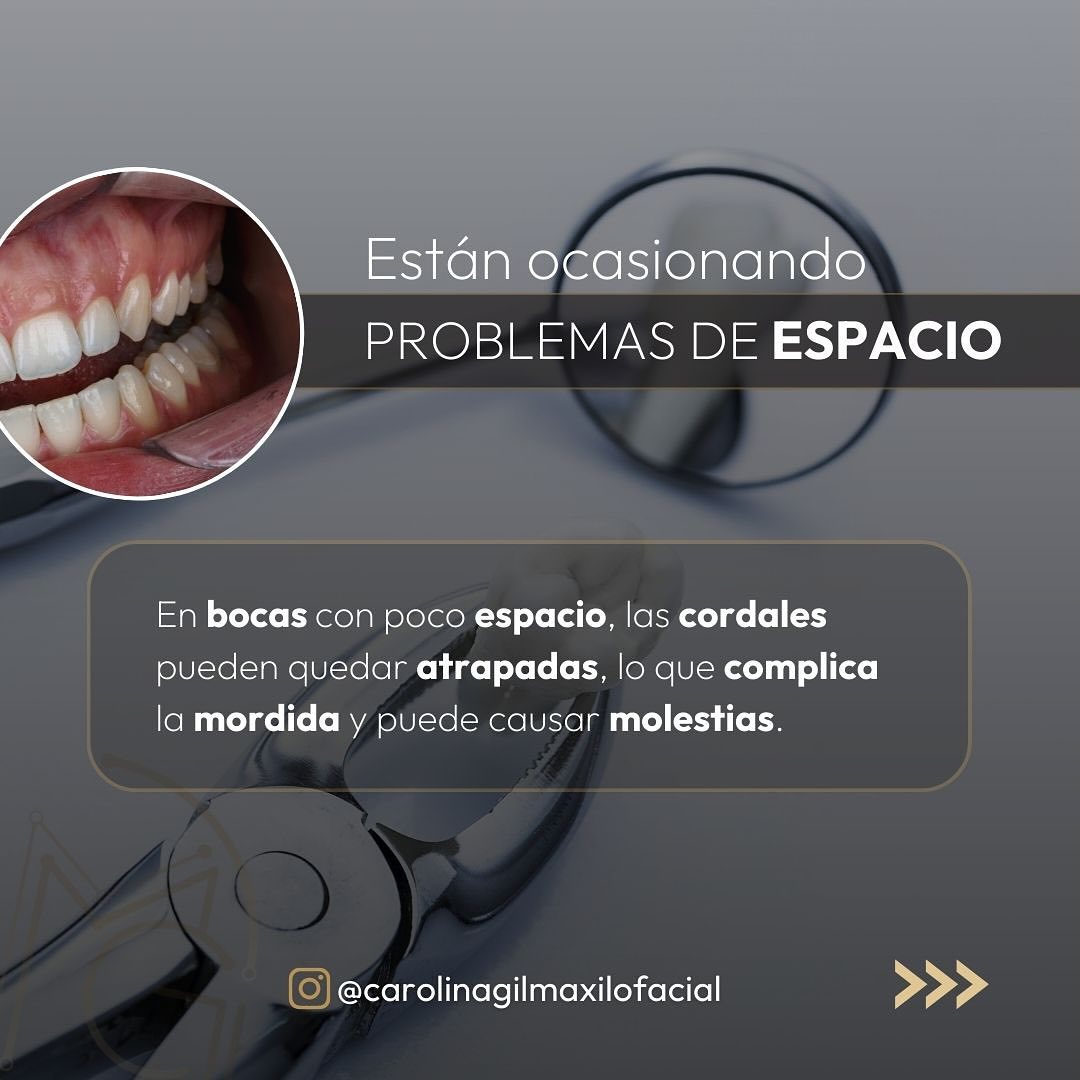 Extraccion de cordales 4