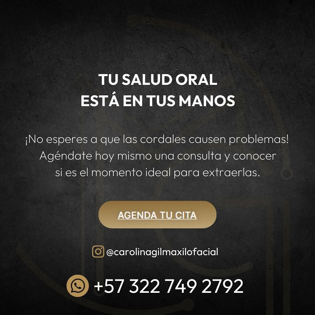 Extraccion de cordales 5