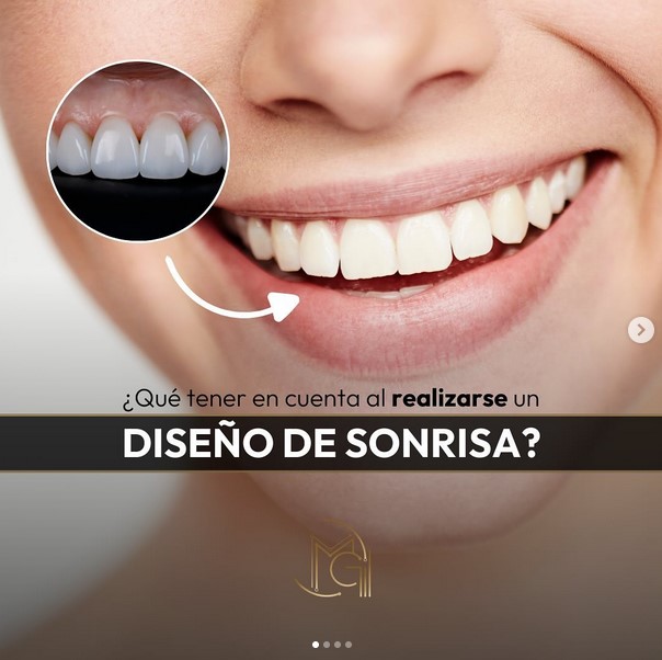 Diseño de sonrisa natural en Bogotá