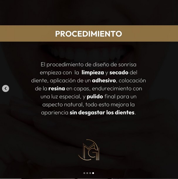 Diseño de sonrisa procedimiento