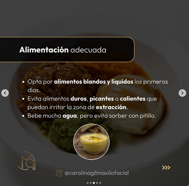 Extracción muelas del juicio en panamá