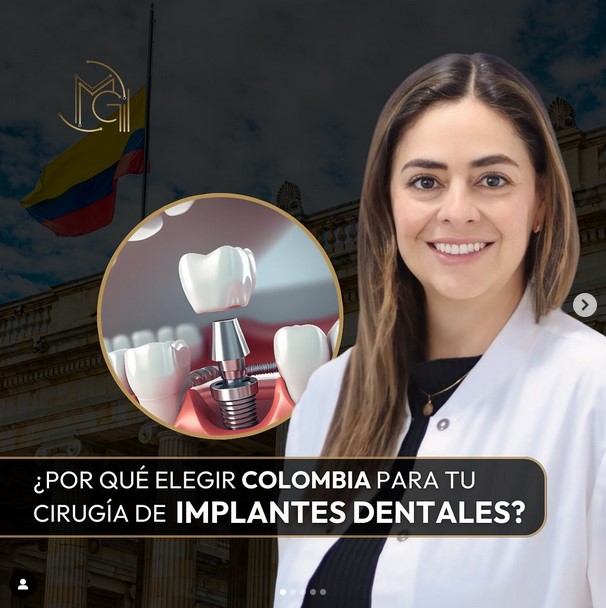 Implantes dentales en Colombia