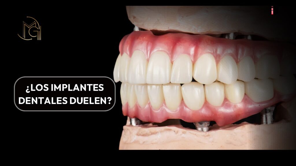 ¿Los implantes dentales duelen?