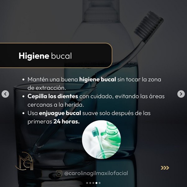 Precio extracción muelas del juicio en Panamá