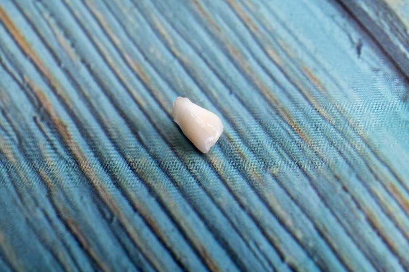 Se me cayó un diente cómo lo pego