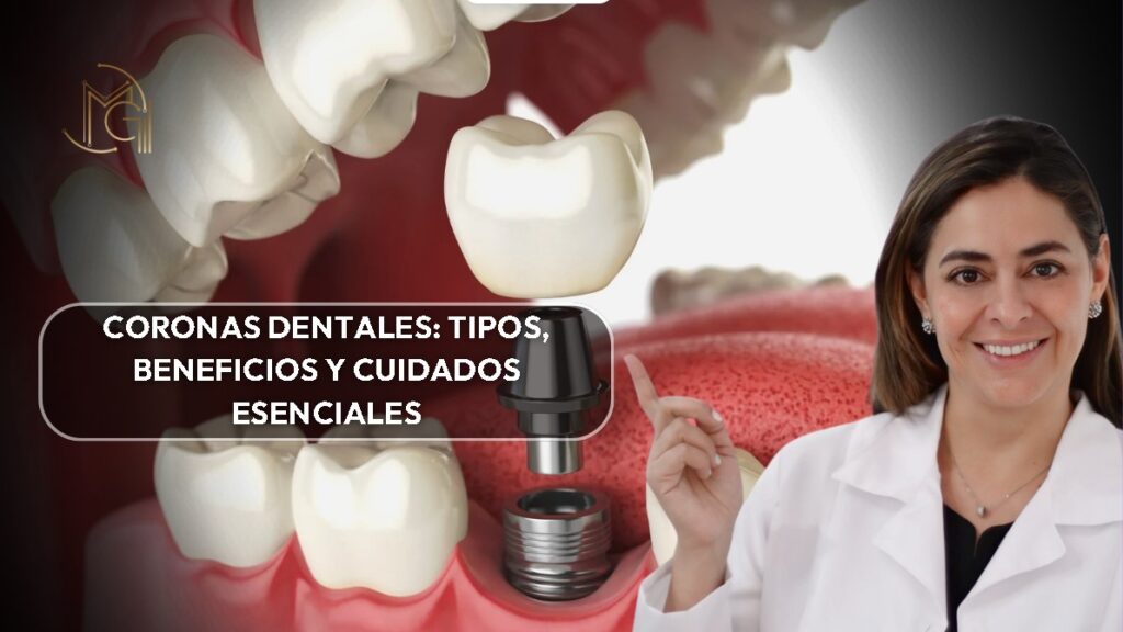 coronas dentales