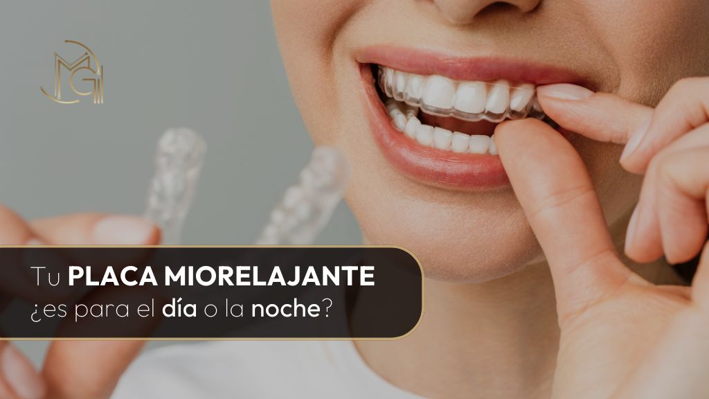 Placas de miorrelajante ¿se usan de día o de noche - Dra. Carolina Gil Cirujana Maxilofacial y Oral