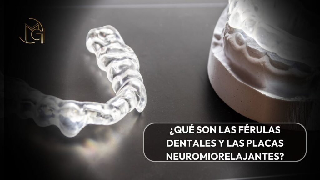 Qué son las férulas dentales y las placas neuromiorelajantes - Odontóloga en Bogotá Carolina Gil