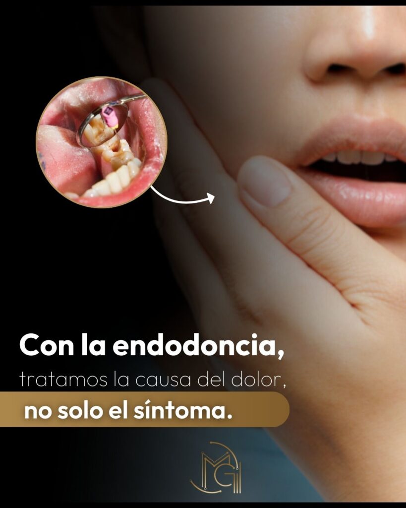 Endodoncia Bogotá-Dra. Carolina Gil- Cirujana Oral y Maxilofacial