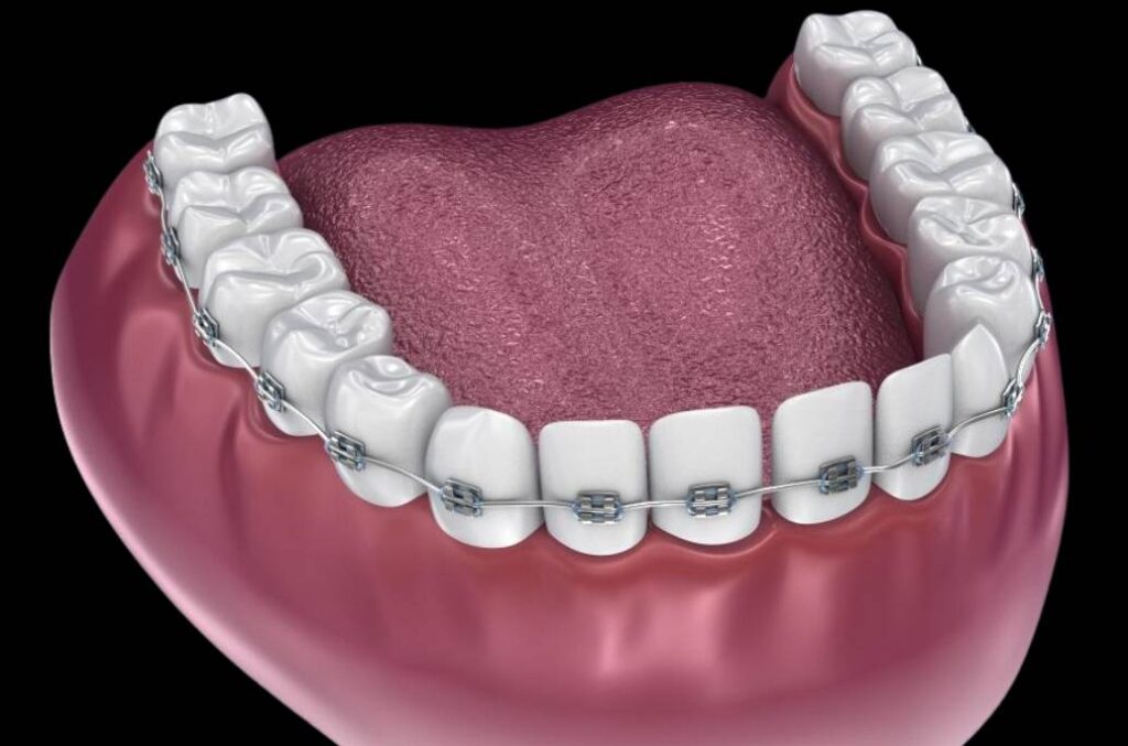 Ortodoncia en Bogotá con Carolina Gil