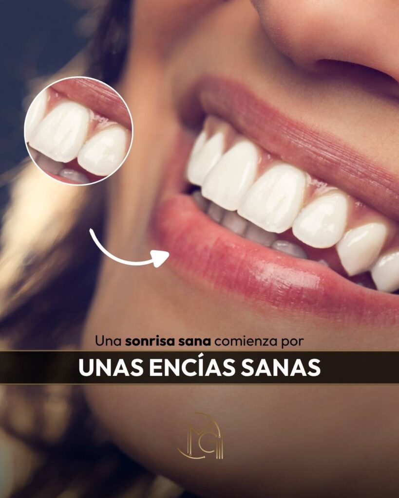 Periodoncia Bogotá - Dra. Carolina Gil - Odontóloga y cirujana oral y maxilofacial en Colombia