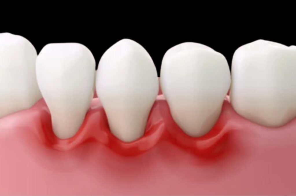 Periodoncia en Bogotá con Carolina Gil