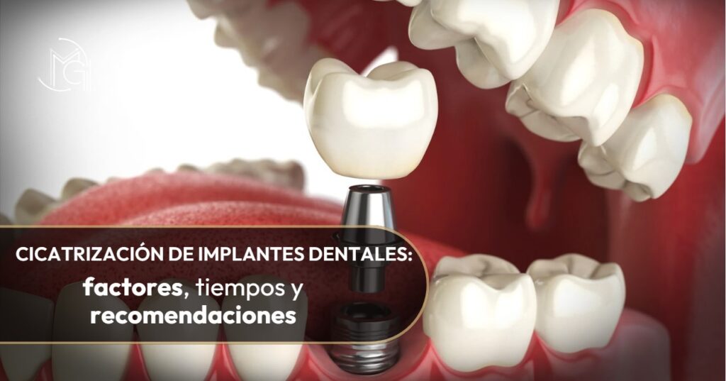 Cicatrización de implantes dentales-Dra. Carolina Gil