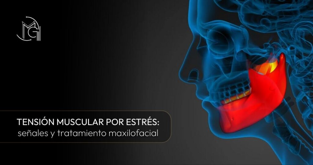 Tensión muscular por estrés señales y tratamiento maxilofacial