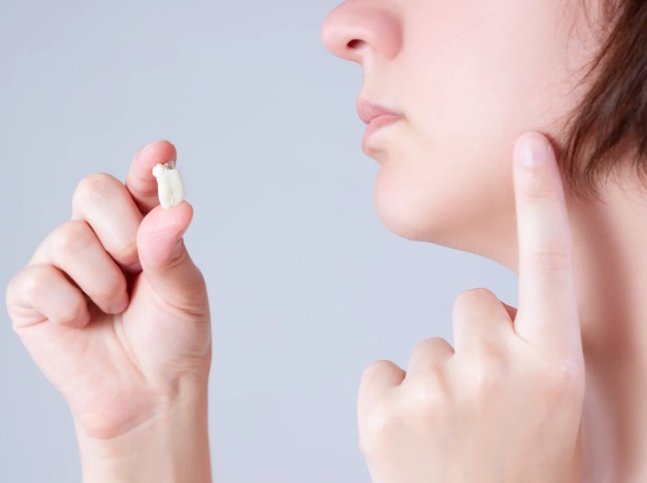 Extracción de cordales en la Clínica odontológica en Bogotá de la Dra. Carolina Gil