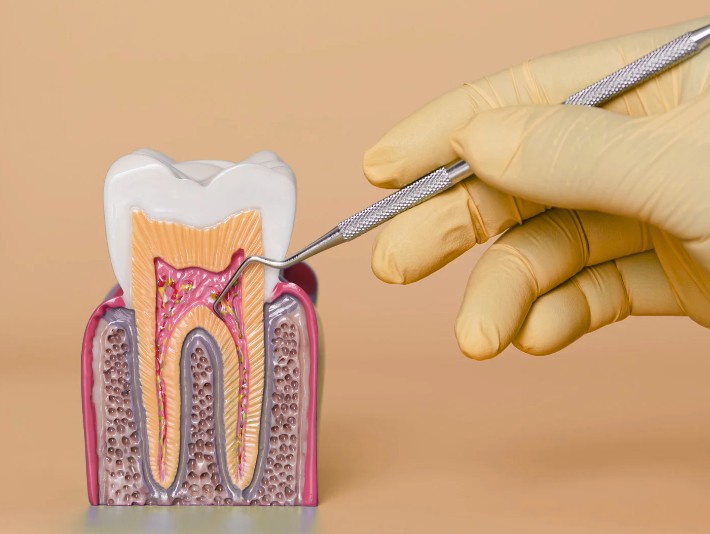 Periodoncia en la Clínica odontológica en Bogotá de la Dra. Carolina Gil