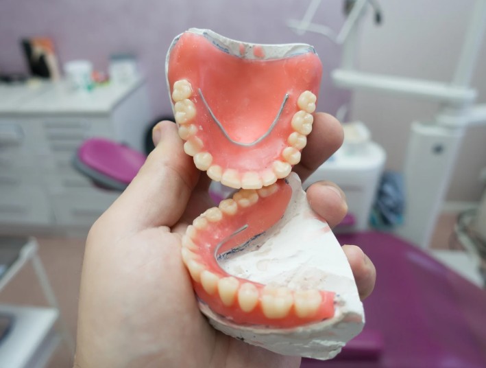 Prótesis híbridas en la Clínica odontológica en Bogotá de la Dra. Carolina Gil