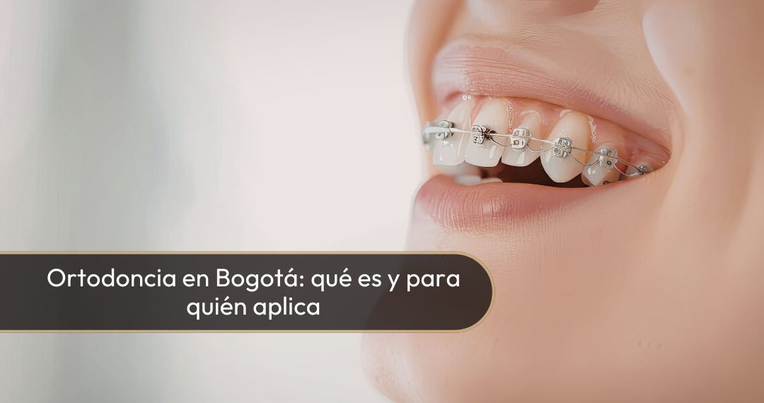 Ortodoncia en Bogotá - Dra. Carolina Gil - Cirujana Maxilofaxial en Bogotá Colombia